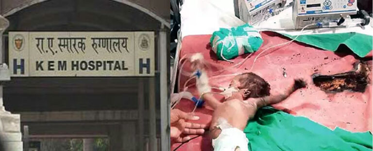 मुंबई: केईएम के ICU में आग, मासूम प्रिंस का हाथ और कान जला
