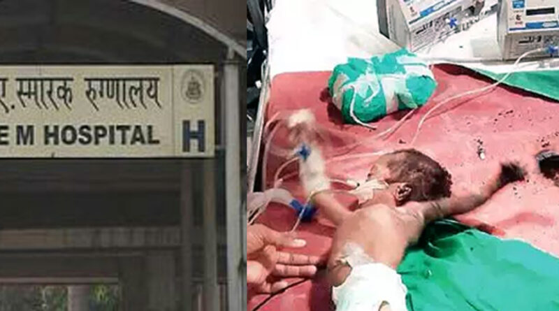 मुंबई: केईएम के ICU में आग, मासूम प्रिंस का हाथ और कान जला