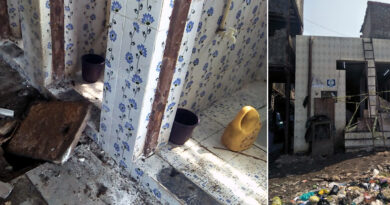 मुंबई: धारावी में टॉयलेट गैस ब्लास्ट होने से २ गंभीर रूप से झुलसे, सायन अस्पताल में चल रहा इलाज