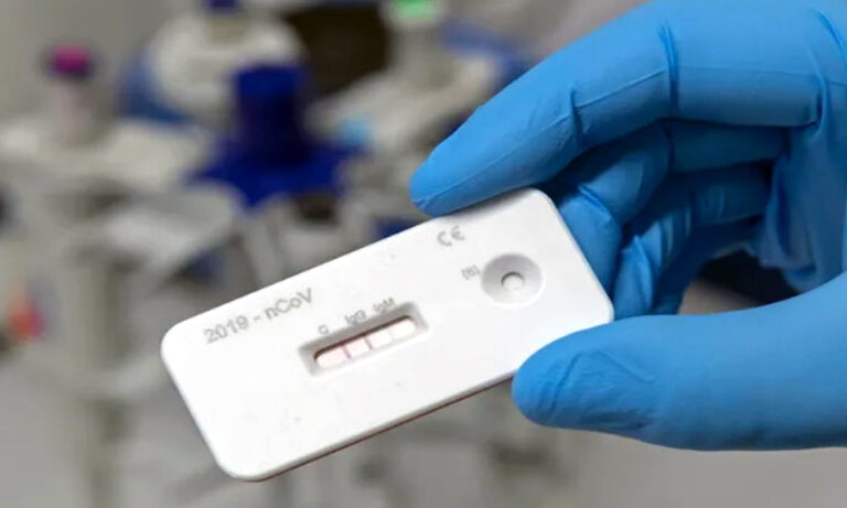 अमेरिका ने विकसित किया घर पर ही कोरोना वायरस की जांच करने वाला टेस्ट किट