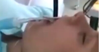 महिला के मुंह से डॉक्टरों ने निकाला चार फीट लंबा सांप, वीडियो वायरल!