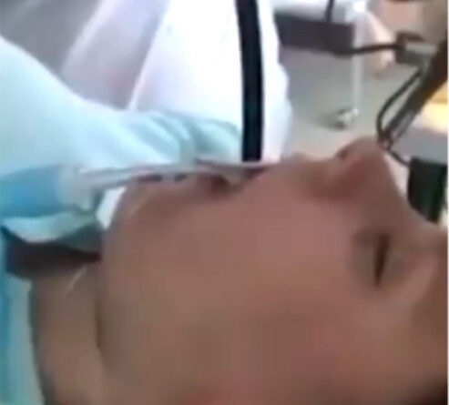 महिला के मुंह से डॉक्टरों ने निकाला चार फीट लंबा सांप, वीडियो वायरल!