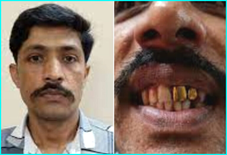 Police nab trickster on the basis of golden tooth implants, here is how it played out