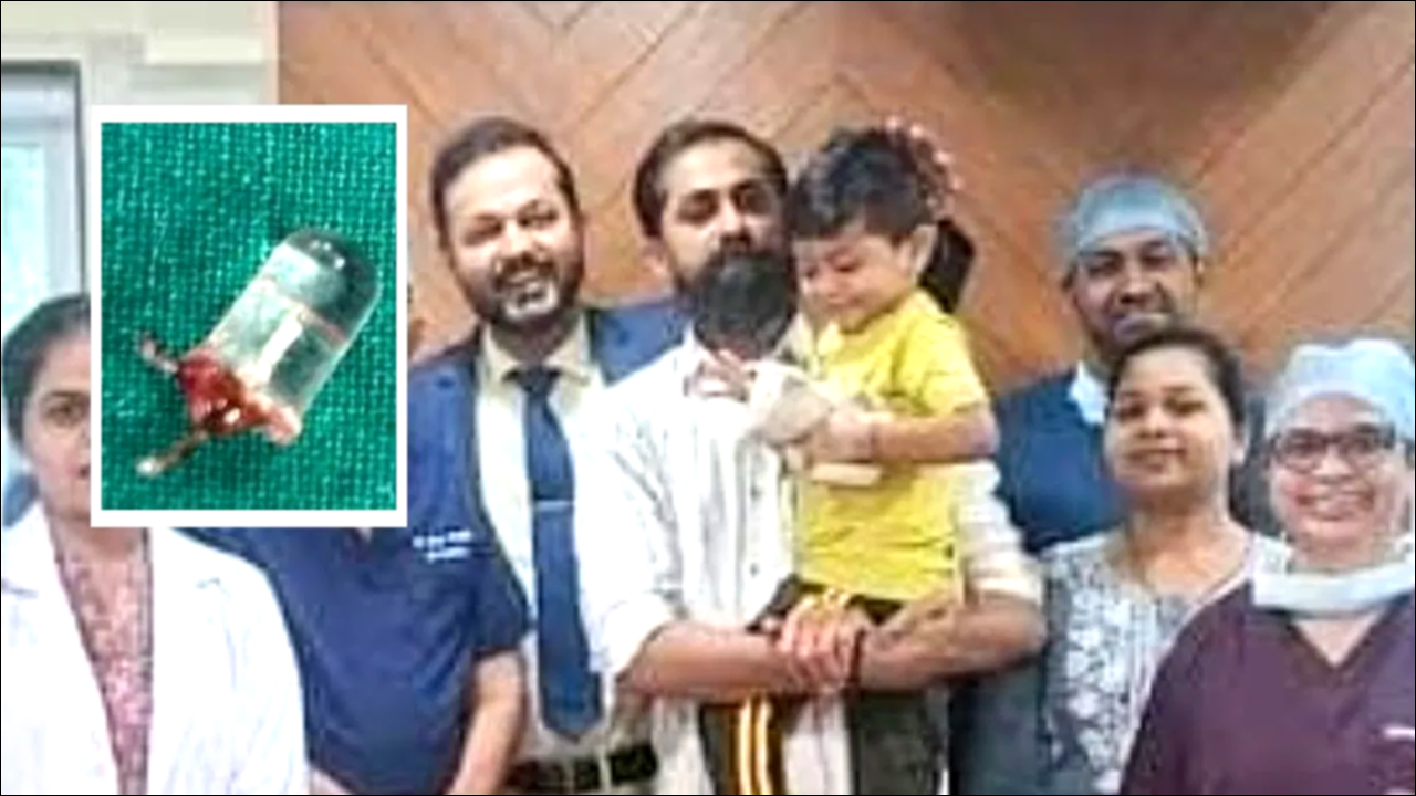 Mumbai: जसलोक अस्पताल के डॉक्टरों ने 3 साल के बच्चे के फेफड़े से निकाला LED बल्ब!